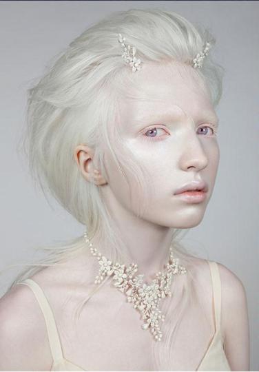Fotografía de la modelo rusa Nastya Zhidkova. A los albinos se les calificaba (y califica todavía a veces) como 